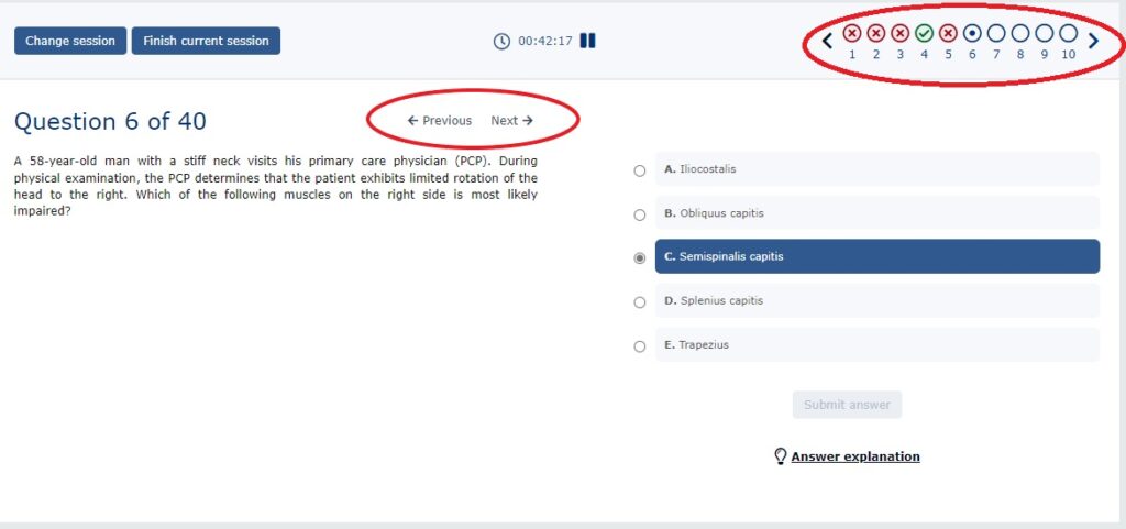 screenshot of a multiple choice question with the Previous and Next menu arrows circled in read, and the question progress bar circled in red