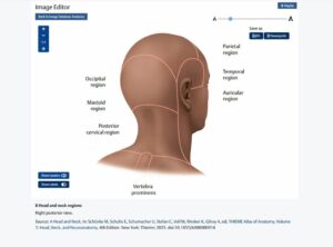 Enhanced anatomy labels on labels off function on MedOne