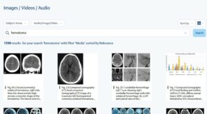 Search keywords in multimedia on MedOne