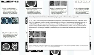 Hover to see details about an image or video