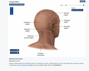 Enhanced View anatomy image on MedOne