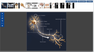 Expand view of image on MedOne