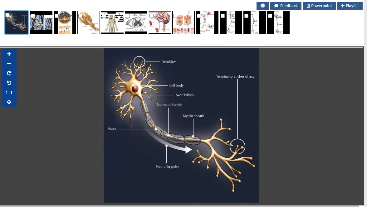 medone_Dendrites